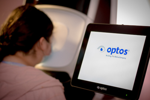 optos eye exam jacksonville at valuvision